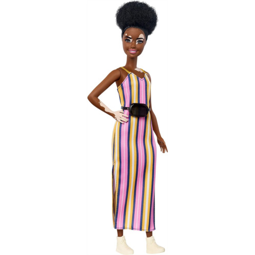 Barbie Fashionistas Doll with Vitiligo